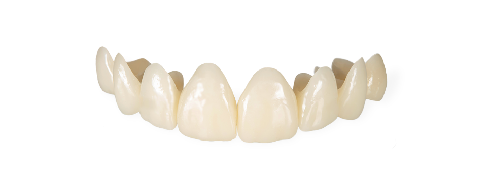 Provisionals – R-Dent Dental Laboratory