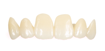 R-Dent INspire UT FCZ crown and bridge